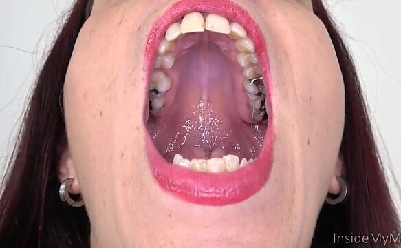 inside mouth